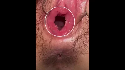 老婆的粉嫩逼洞直接看到子宫口